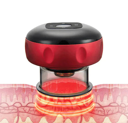 Electric Vacuum Cupping Massager