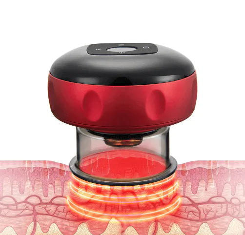 Electric Vacuum Cupping Massager